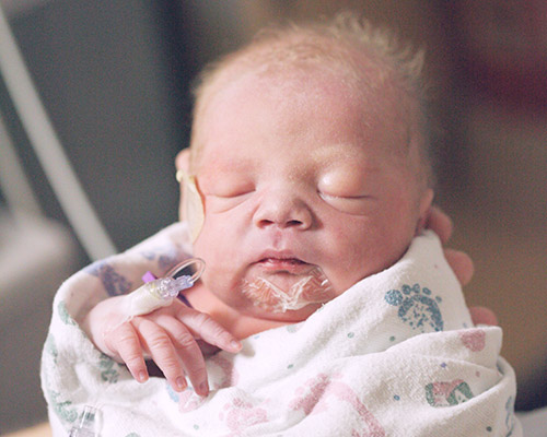 Gangguan Kesehatan Penyakit Bayi Neonatal